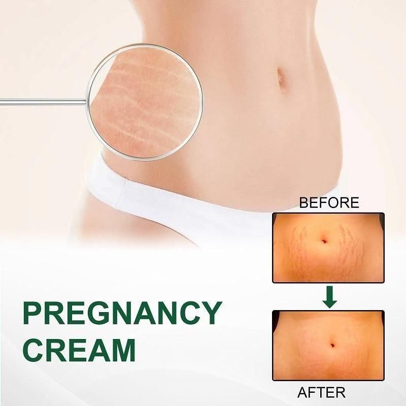 Bejoy Pregnancy Scars, Acne Remove Cream