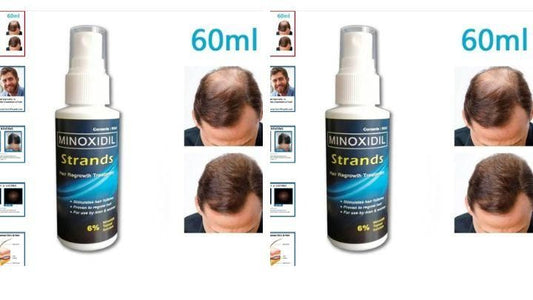 Minoxidil Topical Solution for Men