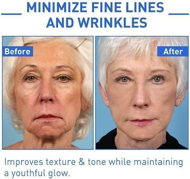 Botox Anti-Aging Serum, Youthfully Botox Face Serum
