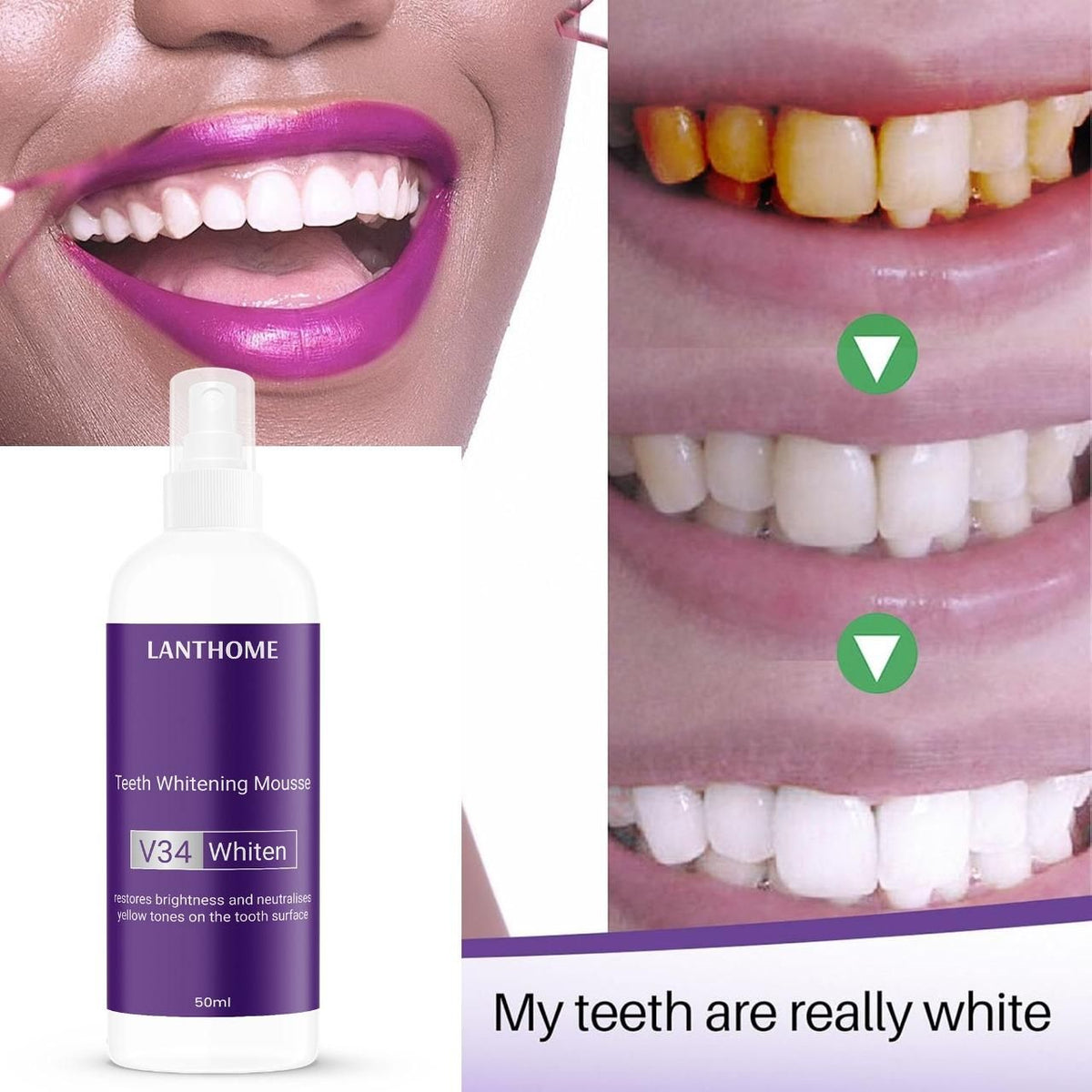 Lathom Teeth Whitening Spray Mousse V34 Whiten 50ml