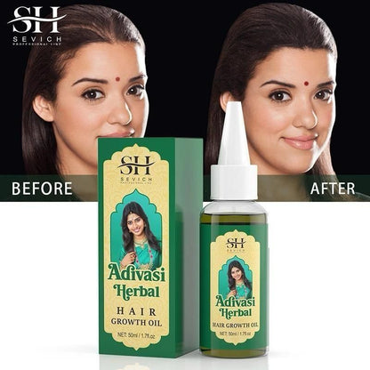 SH Adivasi Hernal Hair Growth Oil 60ml - Nourish Your Roots Naturally