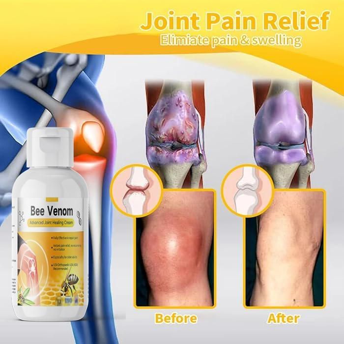 Bee Venom Advanced Joint Healing Cream 400 gm