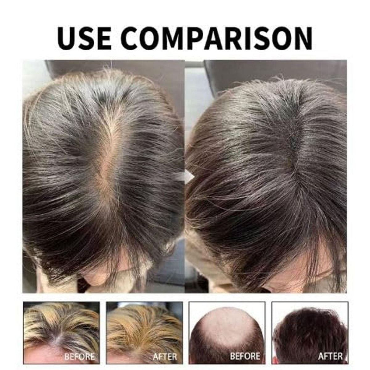 Hair Loss Treatment Serum 30Ml