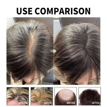 Hair Loss Treatment Serum 30Ml