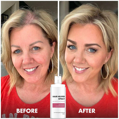 Hair Helper Spray For Hair Growth And Enhancer 100ml