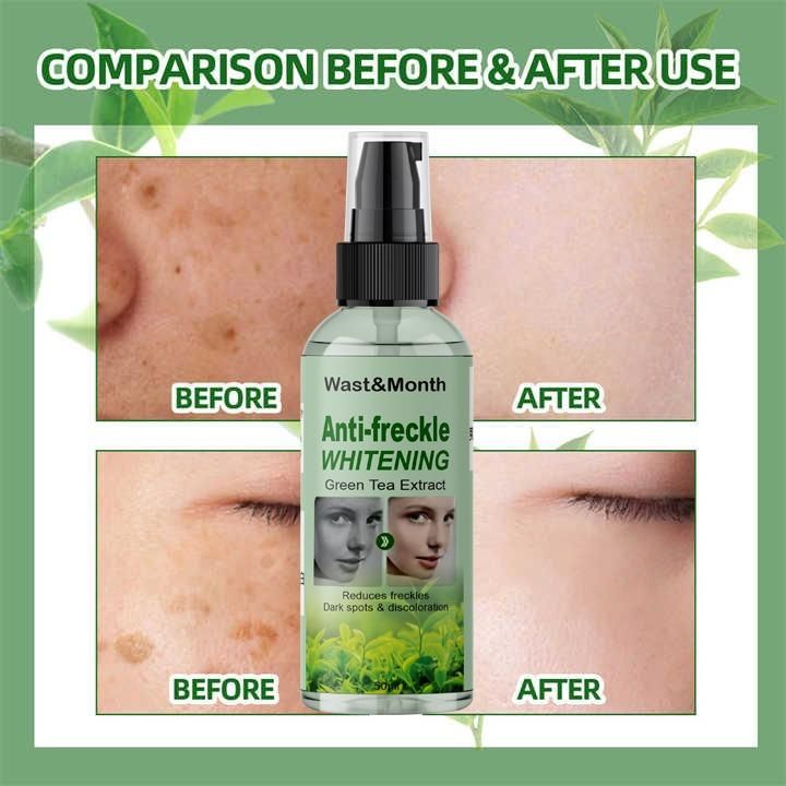 Anti-Freckle Whitening Green Tea Extract 50ML