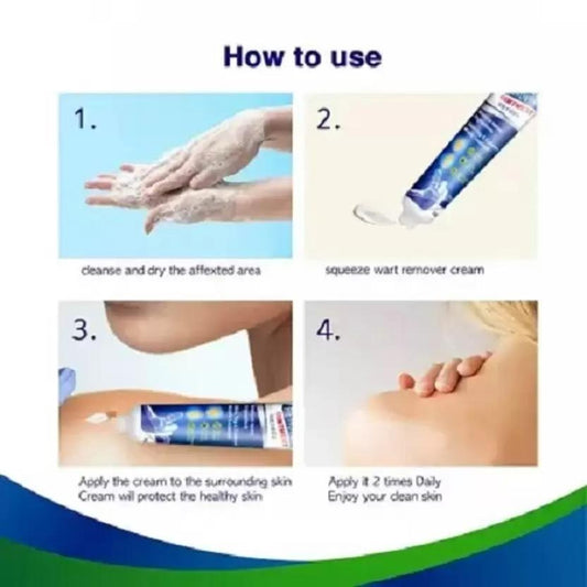 Warts Off Instant Blemish Removal Cream