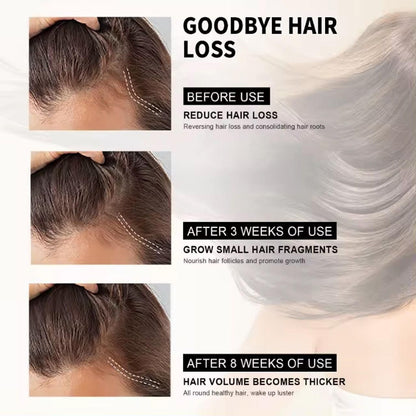Hair Loss Treatment Serum 30Ml