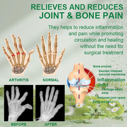 Bee Venom Joint and Bone Therapy Cream 100gm Each