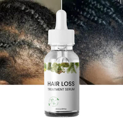 Hair Loss Treatment Serum 30Ml