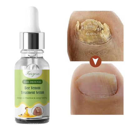 Furgero Nail Defense Bee Venom Treatment Serum 30ml