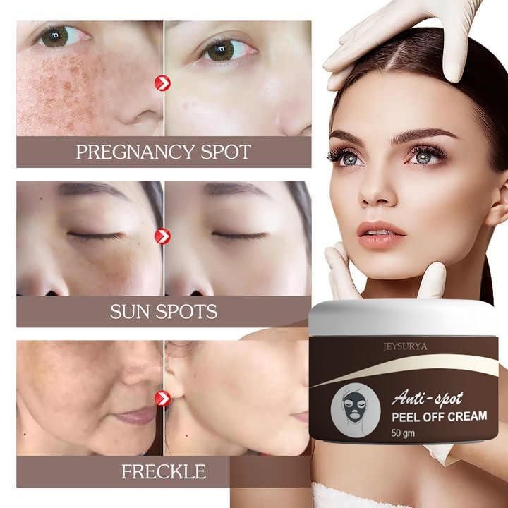 Anti- Spot Peel Off Cream
