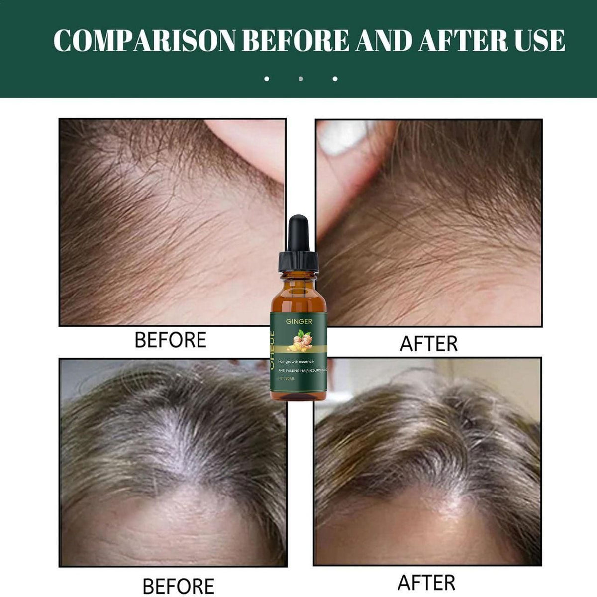 Ginger Hair Growth Essence 60ML Pack of 2