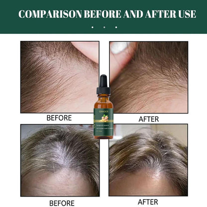 Ginger Hair Growth Essence 60ML Pack of 2