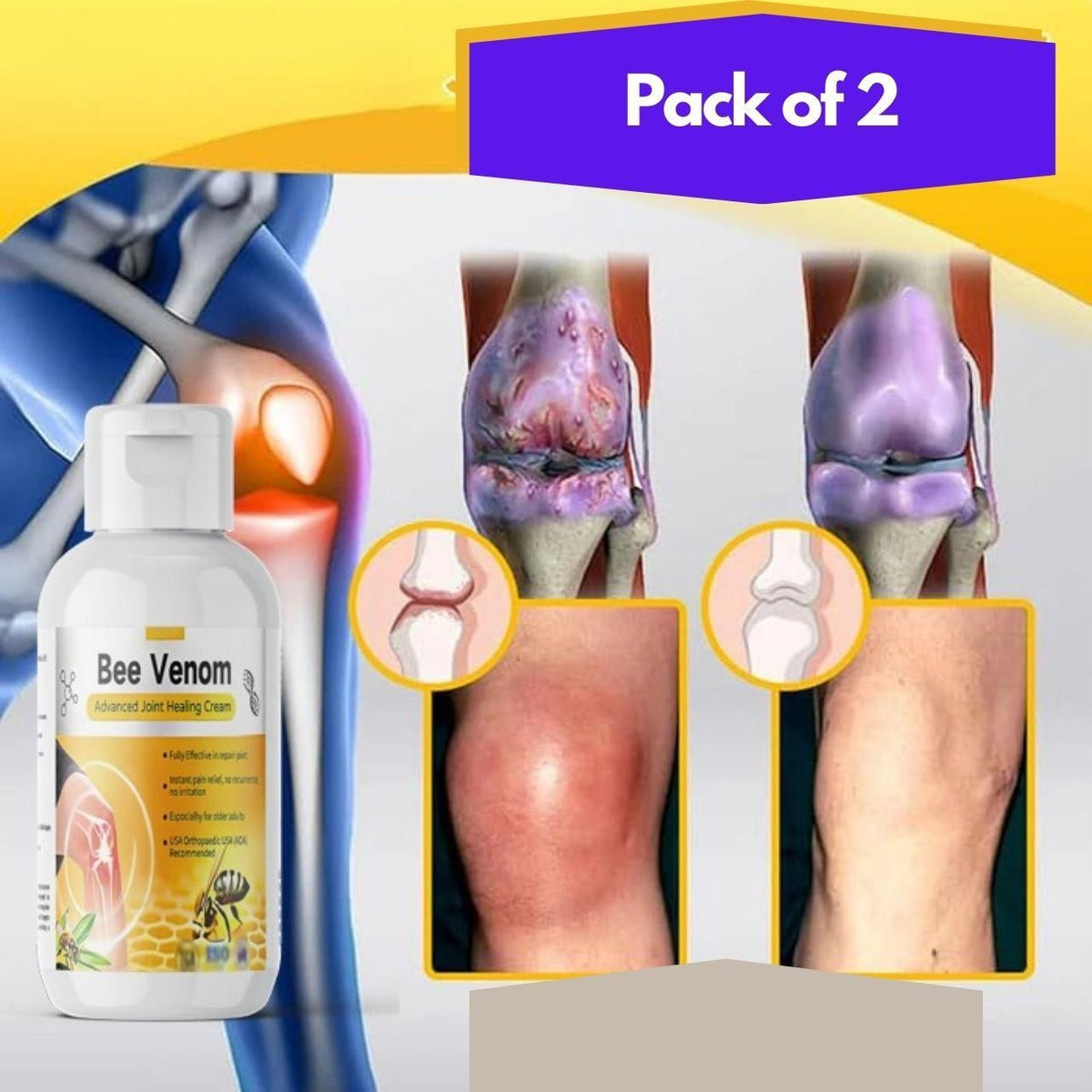 Bee Venom Advanced Joint Healing Cream 400 gm