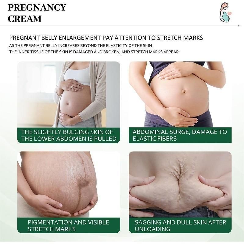 Bejoy  Pregnancy Scars, Acne Remove Cream