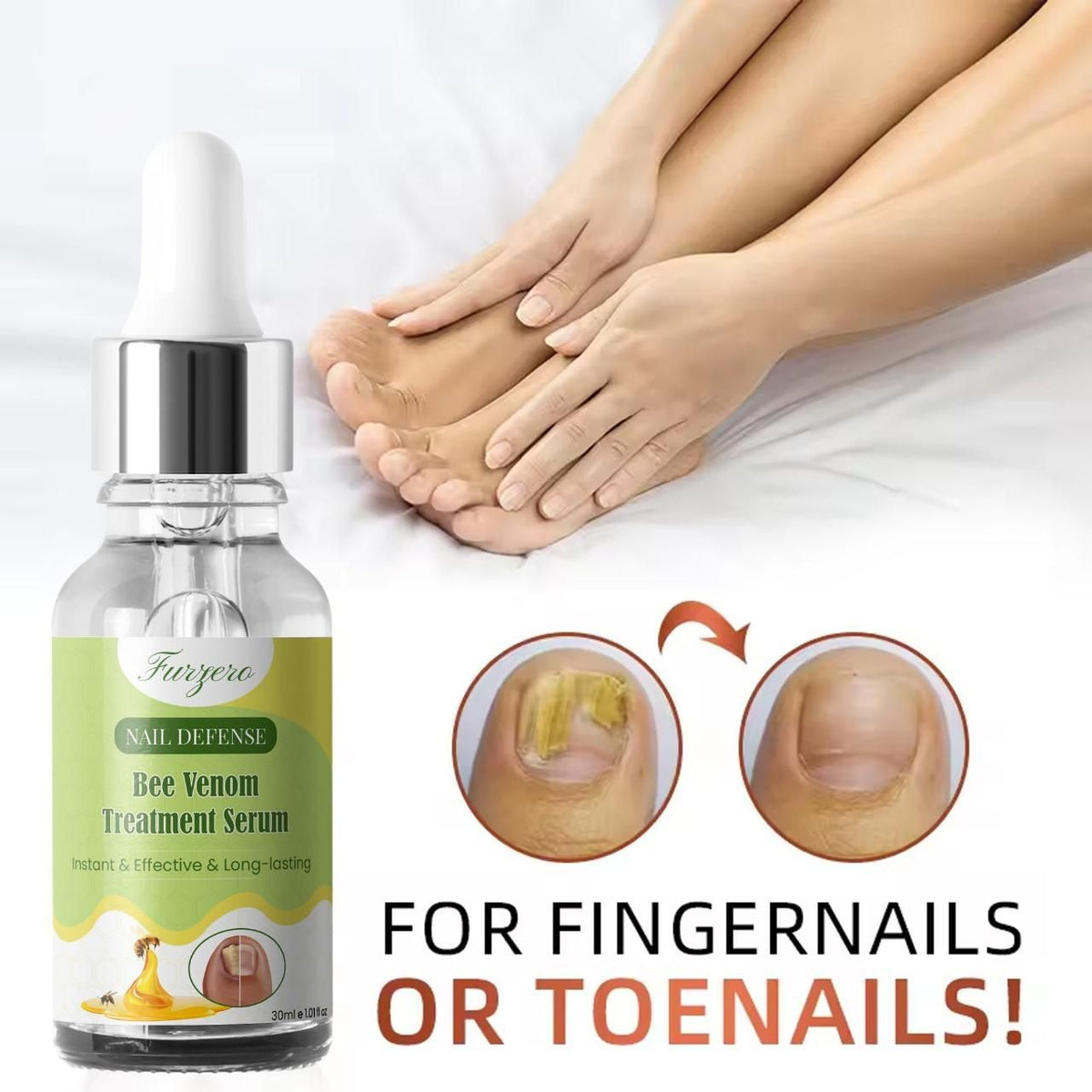 Furgero Nail Defense Bee Venom Treatment Serum 30ml