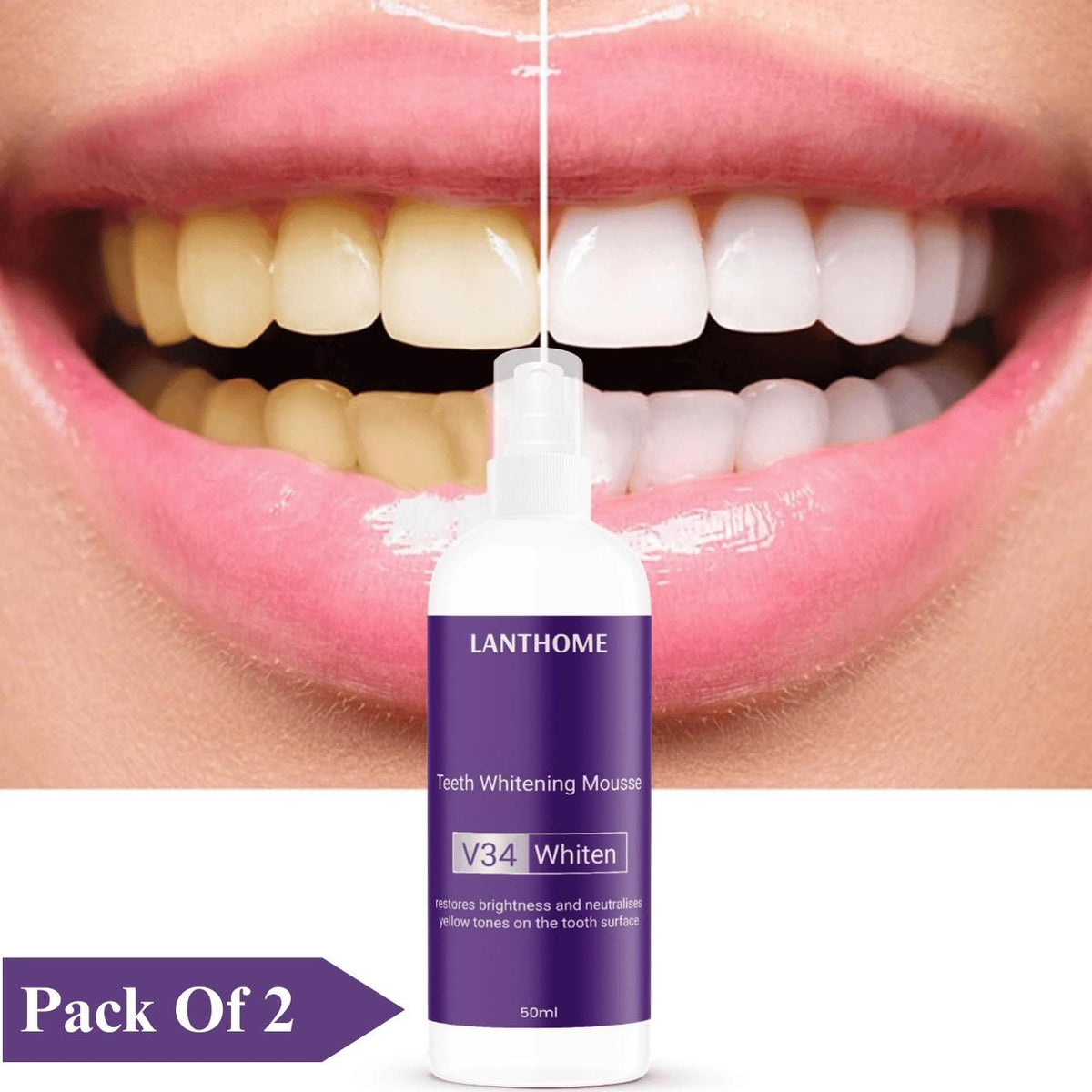 Lathom Teeth Whitening Spray Mousse V34 Whiten 50ml