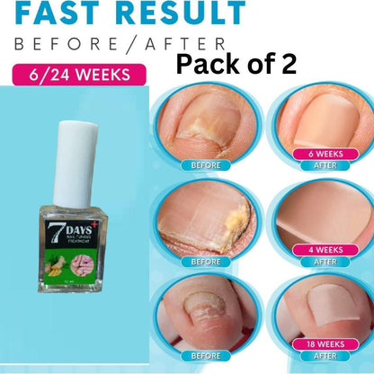 7 Days Nail Fungus Treatment Polish