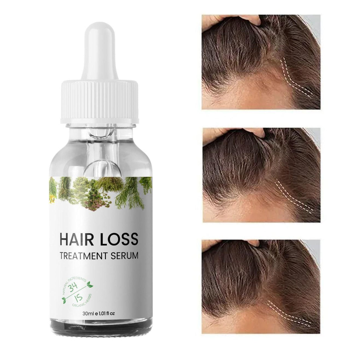 Hair Loss Treatment Serum 30Ml