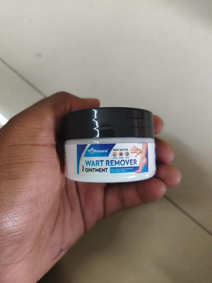 Wart remover cream for wart removal (50gm)