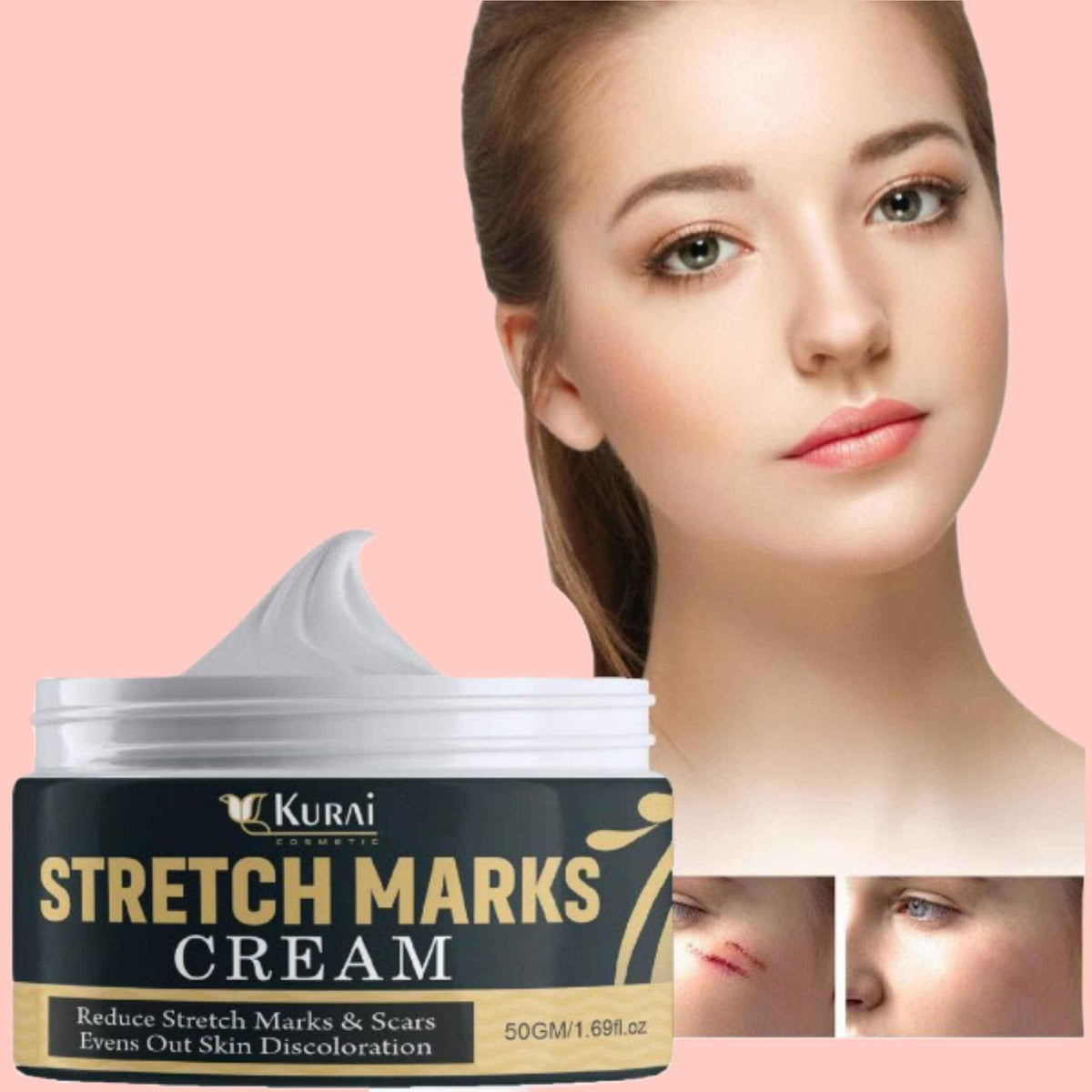 Bejoy  Pregnancy Scars, Acne Remove Cream
