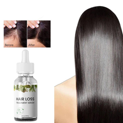 Hair Loss Treatment Serum 30Ml